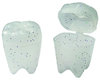 Zahnbehälter Glitzerzahn
